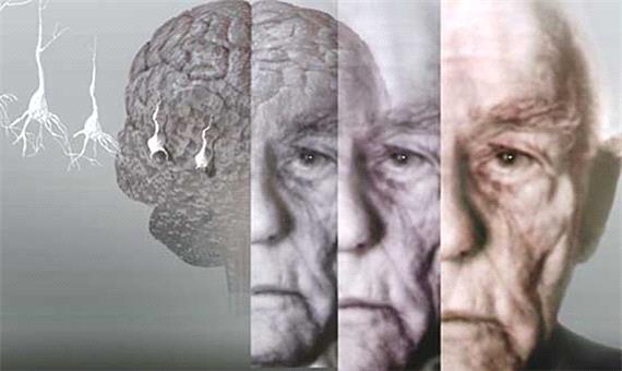 مطالعه مستمر و اجتناب از استرس مانع ابتلا به آلزایمر می‌شود