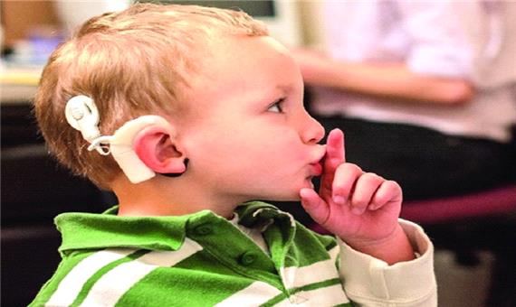 5 نوزاد ناشنوا در خوی امسال برای کاشت حلزون معرفی شدند