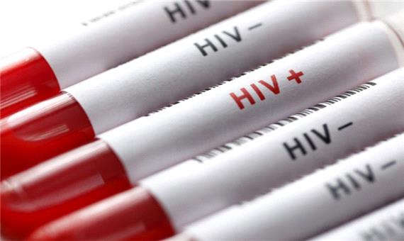 255 بیمار مبتلا به ایدز در آذربایجان شرقی شناسایی شد
